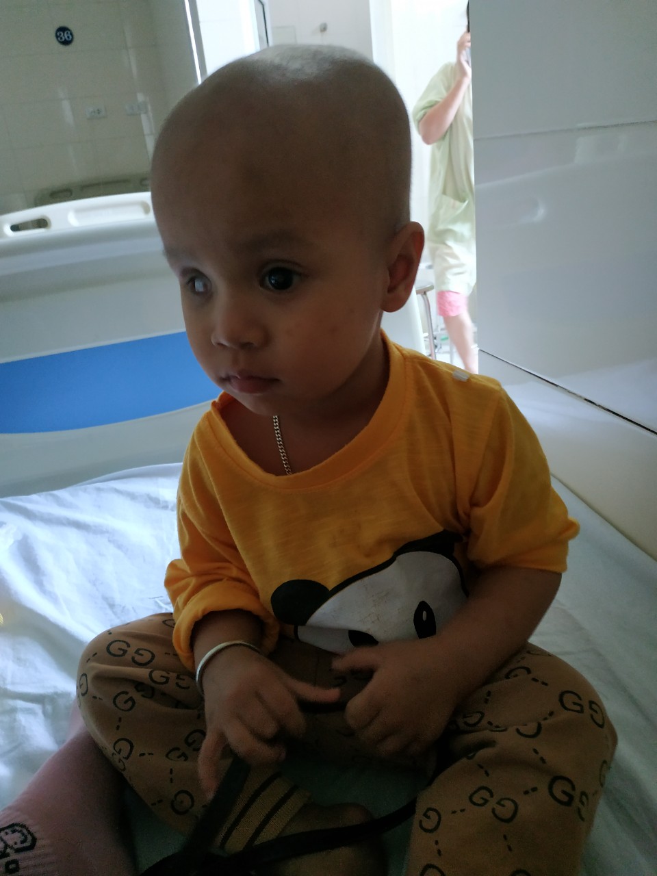 Xót xa bé trai 2 tuổi đôi mắt mất dần ánh sáng vì ung thư - Ảnh 2.