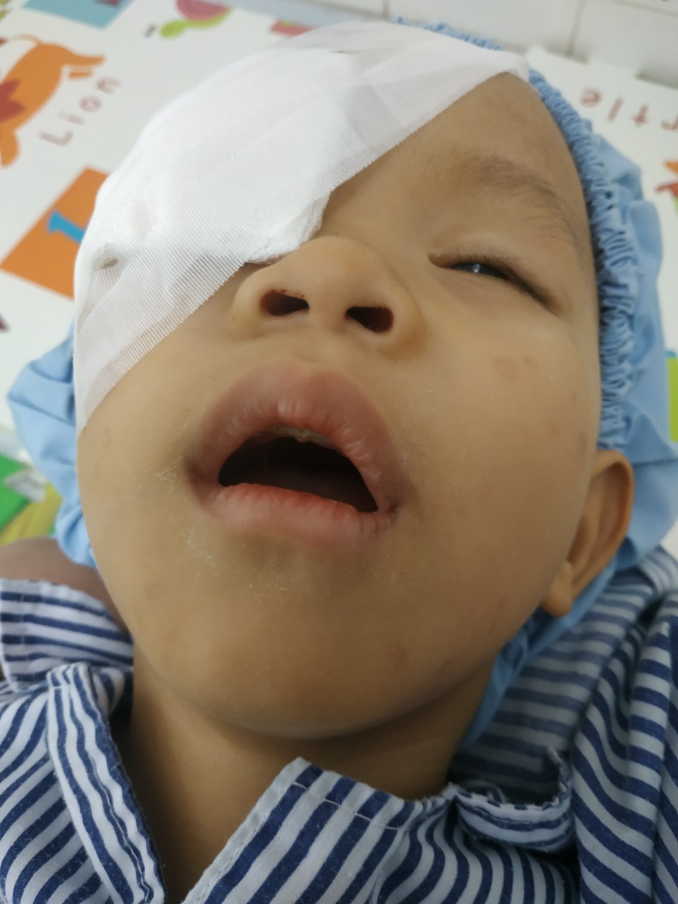 Xót xa bé trai 2 tuổi đôi mắt mất dần ánh sáng vì ung thư - Ảnh 1.