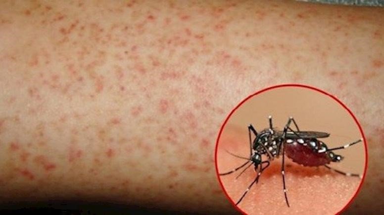 Hình ảnh con Muỗi  Khoa Học Đời Sống