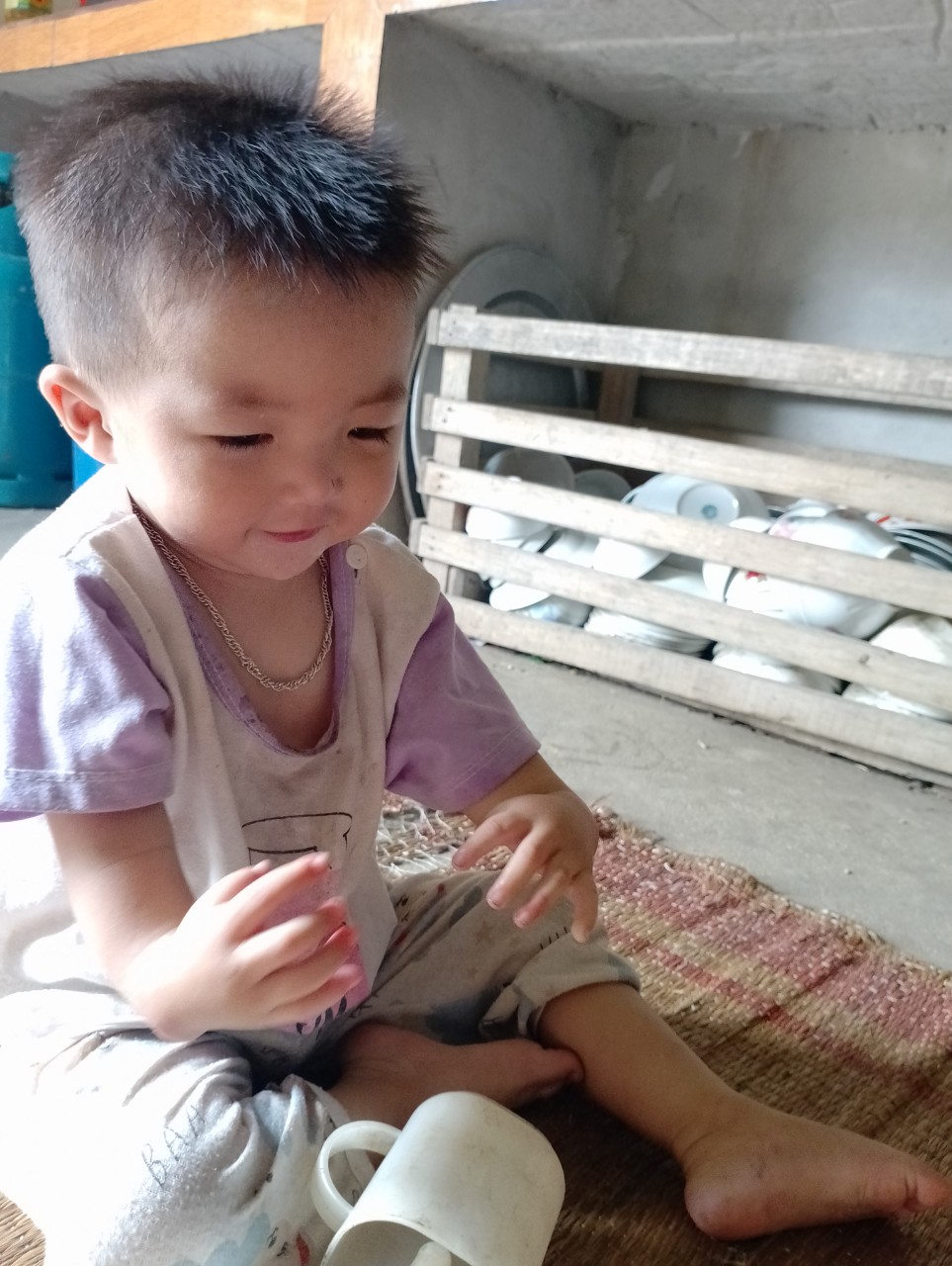 Khuyết tật đôi tay, giờ bé trai dân tộc Dao cần 50 triệu đồng để phẫu thuật tim - Ảnh 1.