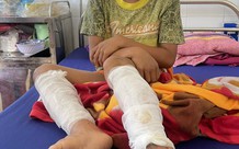Quảng Bình: Bé 9 tuổi bị bố dùng xăng và rơm đốt