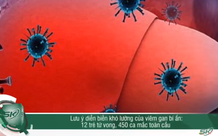 Hoảng hốt diễn biến khó lường của viêm gan bí ẩn: 12 trẻ tử vong, 450 ca mắc tàn cầu