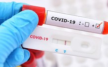 Hà Nội phát hiện 373 người mắc COVID-19