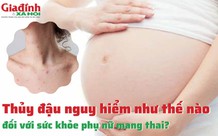 Thủy đậu nguy hiểm như thế nào đối với sức khỏe phụ nữ mang thai?